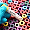 The danger of Legionella contamination